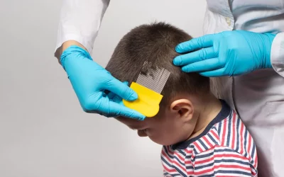 Piojos y vuelta al cole. Recomendaciones para evitar tenerlos y eliminarlos de la cabeza