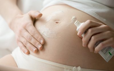 CONSEJOS PARA PREVENIR Y TRATAR LAS ESTRÍAS